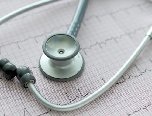 AFib Facts: What to Know About Atrial Fibrillation