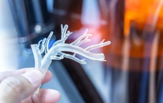 Obesity Linked to Arterial Stiffening